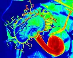 Aristolochia fimbriata